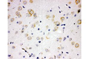 Anti-PAK6 antibody, IHC(P) IHC(P): Rat Brain Tissue