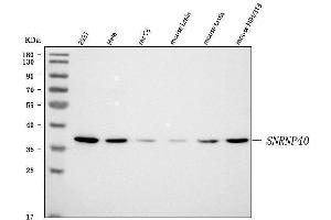 Western blot analysis of SNRNP40 using anti-SNRNP40 antibody (ABIN7601719). (SNRNP40 抗体  (AA 43-357))