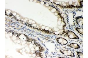 Anti- PKC epsilon Picoband antibody, IHC(P) IHC(P): Rat Intestine Tissue (PKC epsilon 抗体  (AA 53-236))