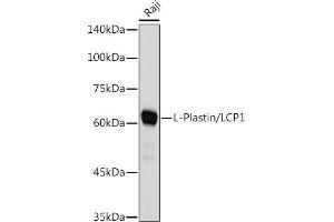 Western blot analysis of extracts of Raji cells, using L-Plastin/LCP1 antibody (ABIN7268317) at 1:1000 dilution. (LCP1 抗体)