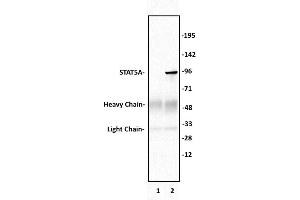 Immunoprecipitation (IP) image for anti-Signal Transducer and Activator of Transcription 5A (STAT5A) (C-Term) antibody (ABIN6972814)