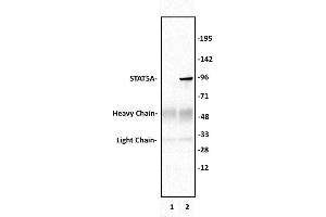 STAT5A antibody (pAb) tested by Immunoprecipitation. (STAT5A 抗体  (C-Term))