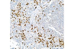 Immunohistochemistry (IHC) image for anti-S100 Calcium Binding Protein A9 (S100A9) (AA 64-114) antibody (ABIN7449432) (Recombinant S100A9 抗体  (AA 64-114))
