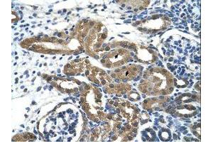 Image no. 1 for anti-Histone Deacetylase 9 (HDAC9) (C-Term) antibody (ABIN205000) (HDAC9 抗体  (C-Term))