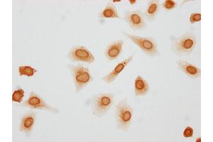 Immunocytochemistry analysis of ABIN7181447 diluted at 1:10 and staining in Hela cells(treated with 50nM Calyculin A for 30 min) performed on a Leica BondTM system. (Histone H1.3 抗体  (pThr146))