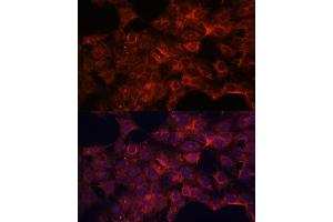 Immunofluorescence analysis of C6 cells using PDP2 antibody (ABIN7269776) at dilution of 1:100.