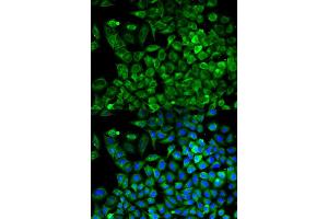 Immunofluorescence analysis of A549 cell using ALDOA antibody. (ALDOA 抗体)
