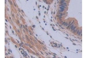 IHC-P analysis of Mouse Uterus Tissue, with DAB staining. (IL12A 抗体  (AA 23-215))
