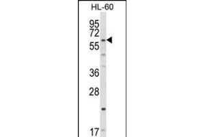 Western Blotting (WB) image for anti-Cytochrome P450, Family 51, Subfamily A, Polypeptide 1 (CYP51A1) (AA 474-503), (C-Term) antibody (ABIN652819)