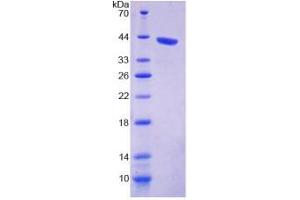 SDS-PAGE analysis of Mouse KIBRA Protein. (WWC1 蛋白)