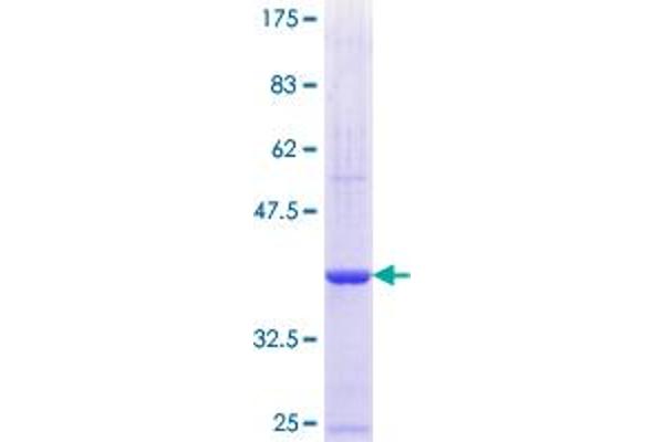 Calpain 3 Protein (CAPN3) (AA 210-309) (GST tag)