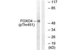 Western blot analysis of extracts from HuvEc cells treated with EGF 200ng/ml 5', using FOXO4 (Phospho-Thr451) Antibody. (FOXO4 抗体  (pThr451))