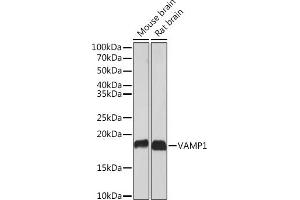 Western blot analysis of extracts of various cell lines, using V Rabbit mAb (ABIN7271312) at 1:1000 dilution.