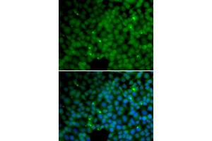 Immunofluorescence analysis of HeLa cells using GGH antibody (ABIN5973177). (GGH 抗体)