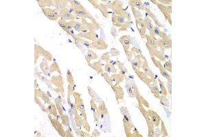 Immunohistochemistry of paraffin-embedded mouse heart using CCT3 antibody. (CCT3 抗体  (AA 1-300))