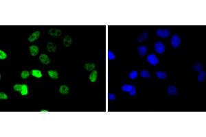MCF-7 cells were stained with Cyclin E1 (4H7) Monoclonal Antibody  at [1:200] incubated overnight at 4C, followed by secondary antibody incubation, DAPI staining of the nuclei and detection. (Cyclin E1 抗体)
