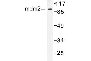 Image no. 1 for anti-Mdm2, p53 E3 Ubiquitin Protein Ligase Homolog (Mouse) (MDM2) antibody (ABIN265516) (MDM2 抗体)