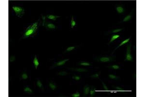 Immunofluorescence of monoclonal antibody to PSME2 on HeLa cell. (PSME2 抗体  (AA 1-239))