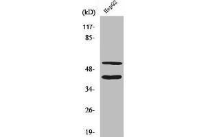Western Blot analysis of HepG2 cells using Cleaved-MMP-10 (F99) Polyclonal Antibody (MMP1 抗体  (Cleaved-Phe99))