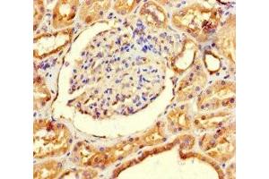 Immunohistochemistry of paraffin-embedded human kidney tissue using ABIN7143697 at dilution of 1:100 (GALM 抗体  (AA 2-342))