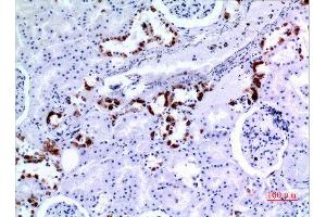 Immunohistochemistry (IHC) analysis of paraffin-embedded Human Kidney, antibody was diluted at 1:100.