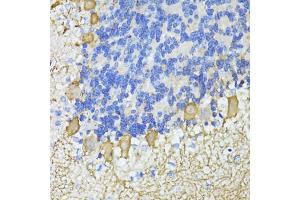Immunohistochemistry of paraffin-embedded mouse cerebellum using C antibody  at dilution of 1:100 (40x lens). (CA8 抗体  (AA 1-290))