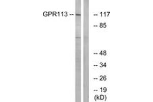 Western blot analysis of extracts from LOVO cells, using GPR113 Antibody.
