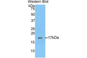 Western blot analysis of the recombinant protein. (GAD 抗体  (AA 1-97))