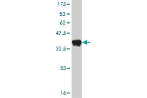 Western Blot detection against Immunogen (37. (FOXA1 抗体  (AA 367-472))