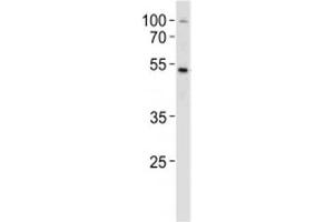 SOX4 antibody western blot analysis in MCF-7 lysate. (SOX4 抗体  (AA 269-297))