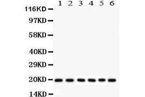 Anti- PIN1 Picoband antibody, Western blotting All lanes: Anti PIN1  at 0. (PIN1 抗体  (AA 1-163))