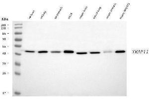 Western blot analysis of THAP11 using anti-THAP11 antibody (ABIN7599230). (THAP11 抗体  (AA 1-294))