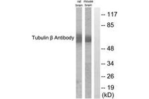 Western blot analysis of extracts from mouse brain/rat brain cells, using Tubulin beta Antibody. (TUBB 抗体  (AA 401-450))