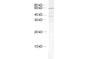 dilution: 1 : 1000, sample: crude synaptosomal fraction of rat brain (P2) (VPS45 抗体)