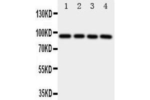 Western Blotting (WB) image for anti-Aryl Hydrocarbon Receptor (AHR) (AA 832-848), (C-Term) antibody (ABIN3043054) (Aryl Hydrocarbon Receptor 抗体  (C-Term))