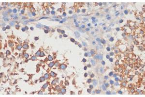 Immunohistochemistry of paraffin-embedded Rat testis using CDC42 Polyclonal Antibody at dilution of 1:100 (40x lens). (CDC42 抗体)