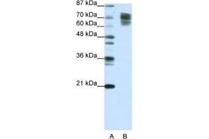 Western Blotting (WB) image for anti-Catenin (Cadherin-Associated Protein), beta 1, 88kDa (CTNNB1) antibody (ABIN2463774) (CTNNB1 抗体)