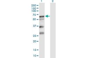 Western Blot analysis of SERPINA10 expression in transfected 293T cell line by SERPINA10 MaxPab polyclonal antibody. (SERPINA10 抗体  (AA 1-444))