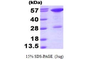 Stress-Induced-phosphoprotein 1 (STIP1) (AA 1-543) protein (His tag)