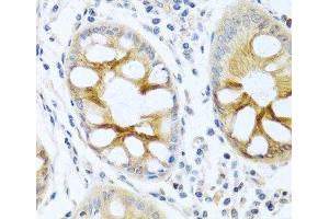 Immunohistochemistry of paraffin-embedded Human colon using PRKCA Polyclonal Antibody at dilution of 1:100 (40x lens). (PKC alpha 抗体)