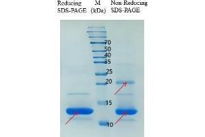 Ubiquitin-Like 5 (UBL5) (AA 1-73) protein (His tag)