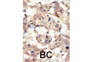 Immunohistochemistry (IHC) image for anti-EPH Receptor B6 (EPHB6) antibody (ABIN3003352) (EPH Receptor B6 抗体)