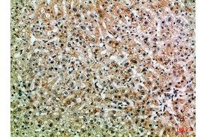 Immunohistochemical analysis of paraffin-embedded Human-liver, antibody was diluted at 1:100 (PPP1R13B 抗体  (AA 630-680))