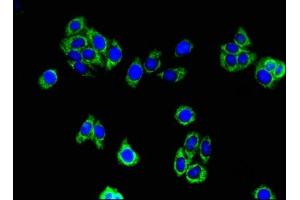 Immunofluorescent analysis of HepG2 cells using ABIN7142316 at dilution of 1:100 and Alexa Fluor 488-congugated AffiniPure Goat Anti-Rabbit IgG(H+L) (ACAA2 抗体  (AA 188-257))