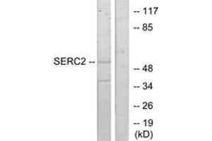 Western blot analysis of extracts from HeLa cells, using SERC2 Antibody. (PSAT1 抗体  (AA 341-390))