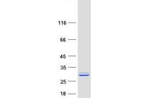 Western Blotting (WB) image for NME/NM23 Family Member 5 (NME5) protein (Myc-DYKDDDDK Tag) (ABIN2727407)