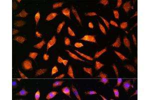 Immunofluorescence analysis of L929 cells using BNP Polyclonal Antibody at dilution of 1:100. (BNP 抗体)