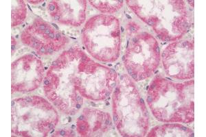 Human Kidney: Formalin-Fixed, Paraffin-Embedded (FFPE) (NFKBID 抗体  (AA 91-119))