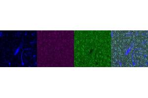 Immunohistochemistry (IHC) image for anti-Insulin-Like Growth Factor Binding Protein 6 (IGFBP6) antibody (ABIN7455987) (IGFBP6 抗体)