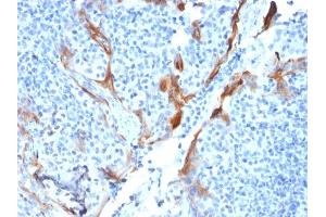 Formalin-fixed, paraffin-embedded human Tonsil stained with Cytokeratin 16 Mouse Recombinant Monoclonal Antibody (KRT16/1714). (Recombinant KRT16 抗体  (C-Term))